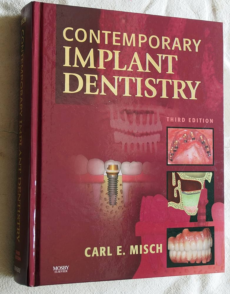 Amazon.com: Contemporary Implant Dentistry: 9780323043731: Misch